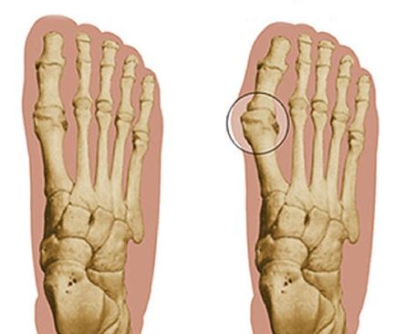 The development of the foot