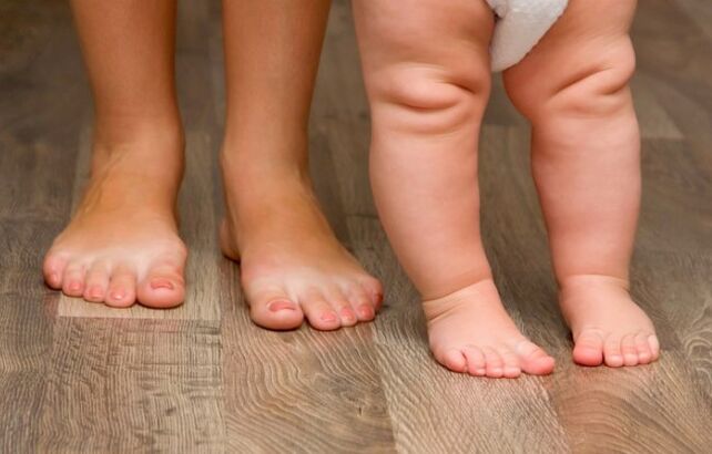 The deformation of the skirt in children