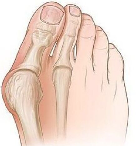A group of thumb
