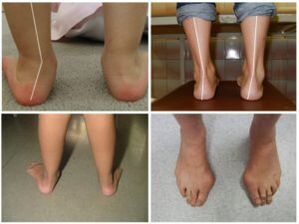 Types of curvature